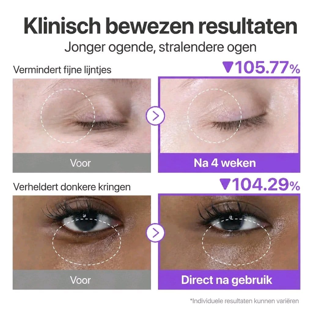 Numbuzin No.9 NAD+ Rétinol Crème Contour des Yeux Set avec Saumon-PDRN - Raffermissant & Hydratant